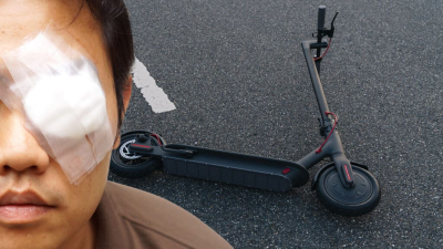 В Алматы самокатчик выбил глаз мужчине